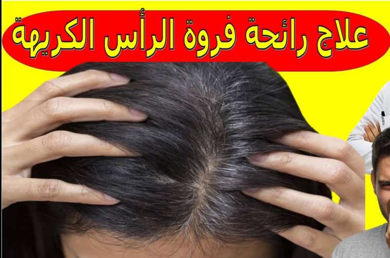 رائحة فروة الشعر الكريهة